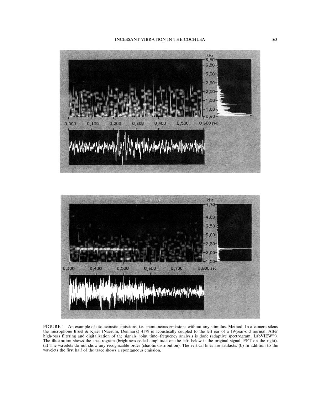 INCESSANT VIBRATION IN THE COCHLEA 163 FIGURE An example of oto-acoustic emissions, i.e. spontaneous emissions without any stimulus.