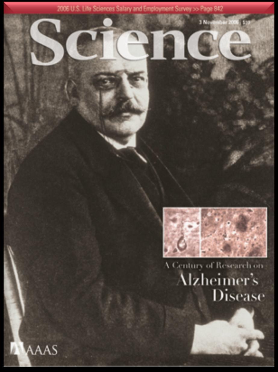 Ongoing sudy 100 Years of Research on Alzheimer s Disease