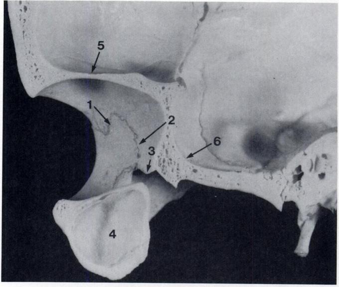 Facial fractures Dolan et al. B. RADIOGRAPHIC ANATOMY Figure 5C A dried skullpreparat!