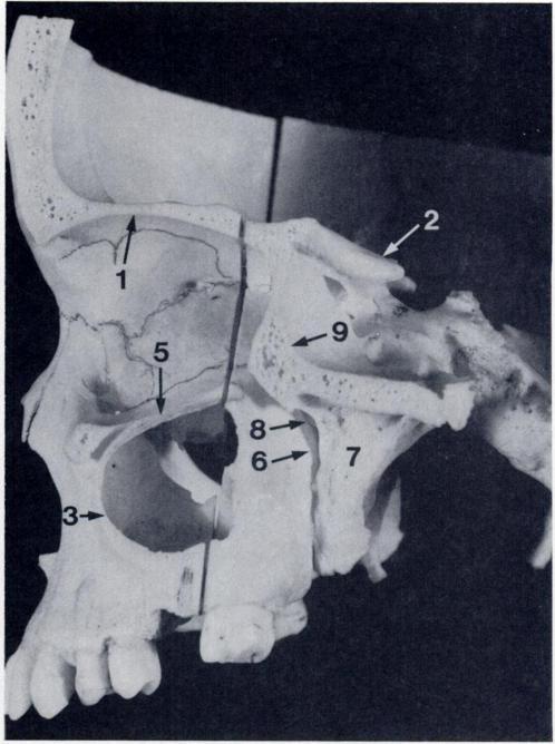 Figure 5E A comparative dried skull preparation cut through the same plane as that shown in Figure 5D 1. Orbital roof 2.