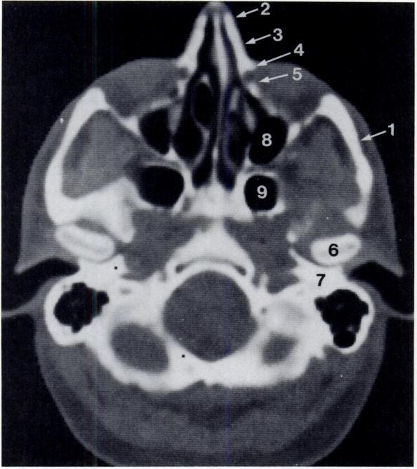 Facial fractures Dolan et al. C.