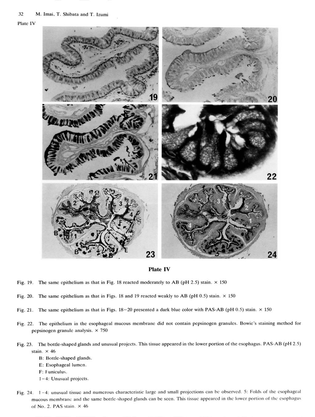 32 M. Imai, T. Shibata and T. Izumi IV IV Fig. 19. The same epithelium as that in Fig. 18 reacted moderately to AB (ph 2.5) stain. x 150 Fig. 20. The same epithelium as that in Figs.