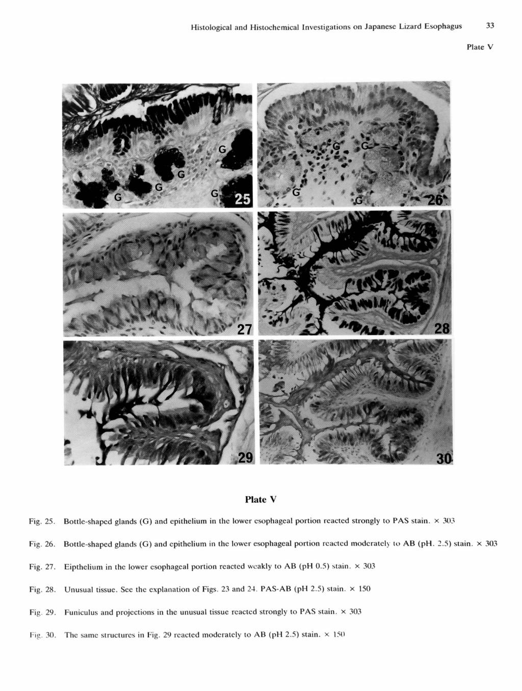 Histological and Histochemical Investigations on Japanese Lizard Esophagus 33 V V Fig. 25. Bottle-shaped glands (G) and epithelium in the lower esophageal portion reacted strongly to PAS stain.