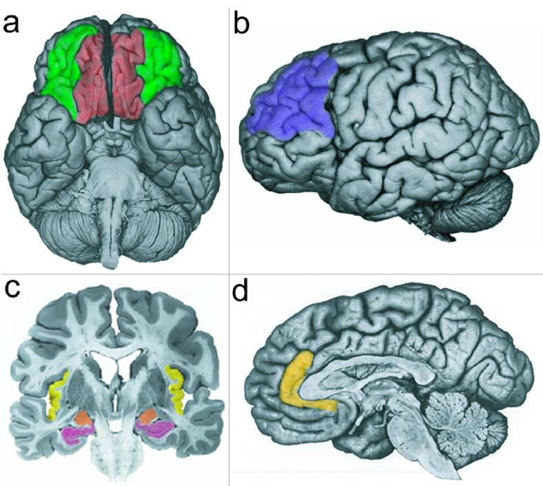 Neuroanatomy of Anxiety Disorders Key Brain Areas Orbitofrontal cortex (OFC) Dorsolateral prefontal cortex