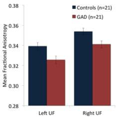 Group Differences in Uncinate Fasciculus GAD Patients Show Reduced