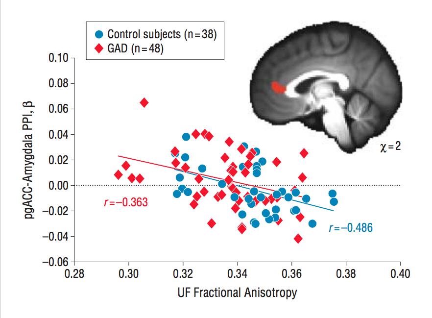 Uncinate Fasciculus Structural Connectivity Associations with Anticipatory