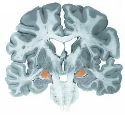 Neuroanatomy of Emotion Key Brain Areas and Their Affect-related Functions