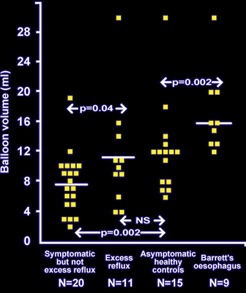 Esophageal Hypersensitivity Very Common in NERD Trimble KC et al. Gut 1995;37:7-12. Maradey Romero et al.