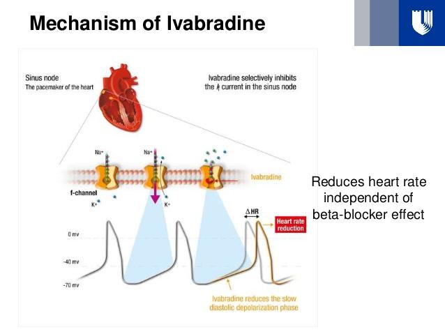 Ivabradine SHIFT (2010): EF 35%, NYHA II-IV, resting HR > 70 despite max medical therapy including beta blockers 5% absolute reduction in HFhospitalization and 2% absolute reduction in HF-related