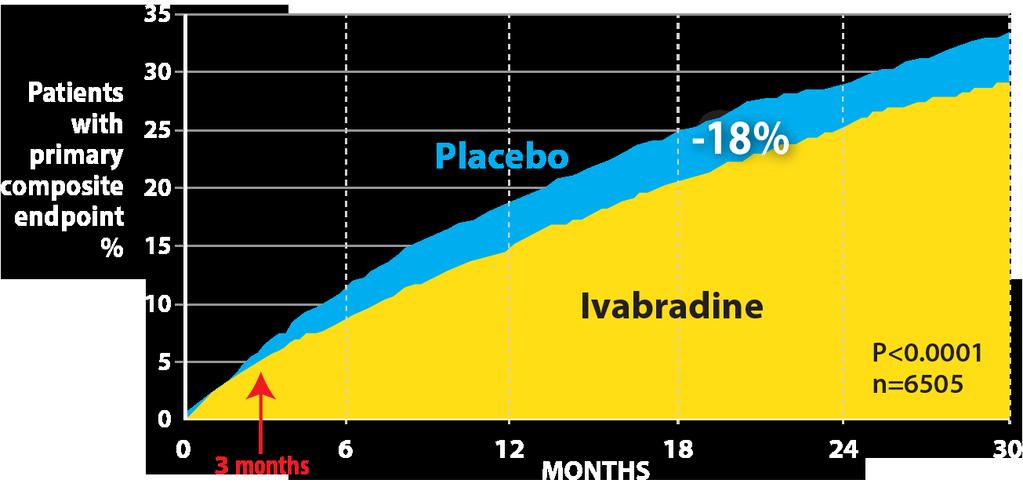 Ivabradine Effects on Combined