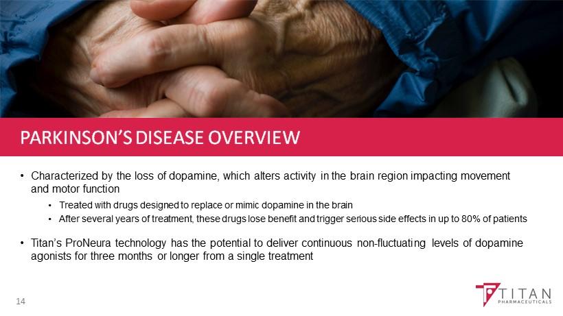 PARKINSON S DISEASE OVERVIEW Characterized by the loss of dopamine, which alters activity in the brain region impacting movement and motor function Treated with drugs designed to replace or mimic