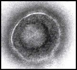 Herpesviruses pathogenicity depends on host s immunological status: efficient