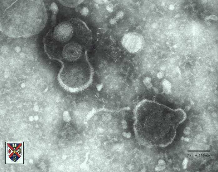 Varicella Zoster Virus Human Herpesvirus 3 Subfamily: Alphaherpesvirinae Genus: Varicellovirus VZV Chickenpox (Varicella) Shingles (Zoster) transmission: respiratory secretions or direct contact (the