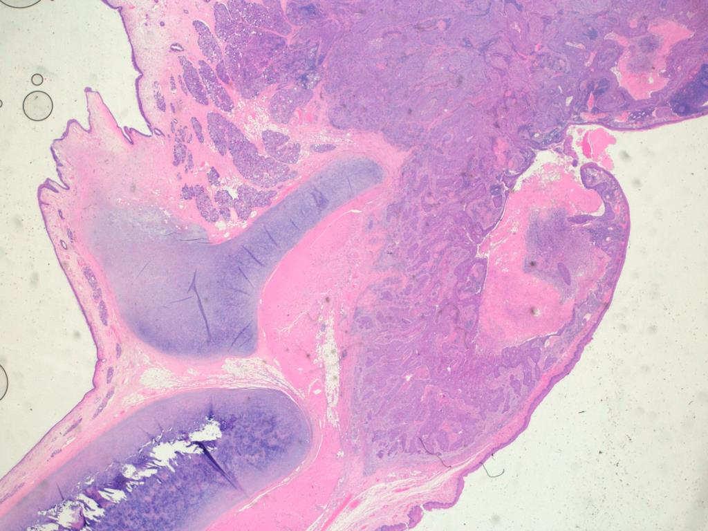 Larynx Arytenoid cartilage
