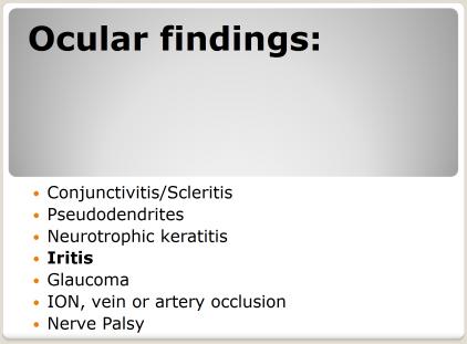 Scleritis Ocular findings: Conjunctivitis/Scleritis Pseudodendrites Neurotrophic keratitis Iritis Glaucoma ION, vein or