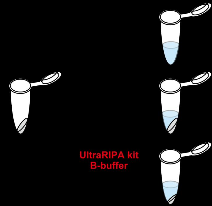 ULTRARIPA kit can efficiently extract lipid raft proteins