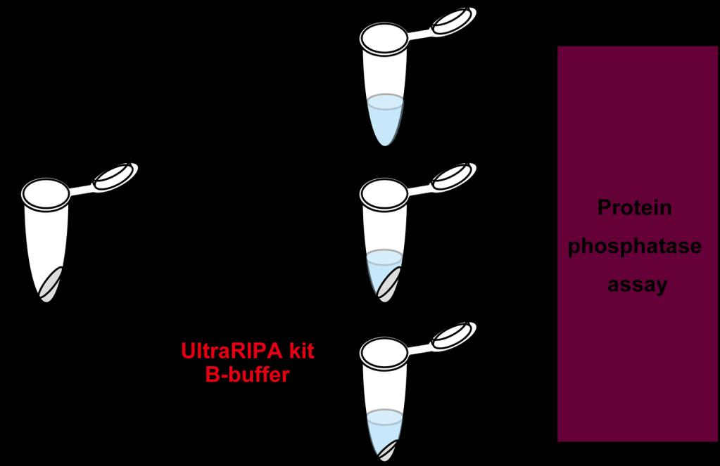 Detection of enzymatic activities of lipid raft enzymes Validation 4: Can ULTRARIPA