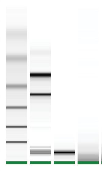 Supplementary Figure 4 Adult Exo Sup Adult Exo Sup Supplementary Figure 4: Bioanalyzer profile of total