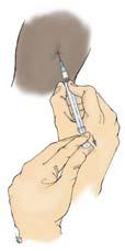 administration Pull back on syringe plunger to aspirate for