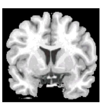Brain Neuroscience f MRI images of