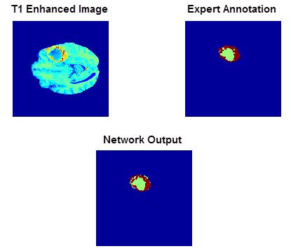 The deconvolution layers are followed by ReLU activations and batch-normalization. This model uses softmax cross-entropy loss with L2 regularization and is trained using Adam optimization.