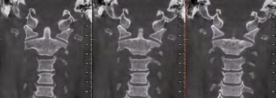 maxillofacial are within a single scan