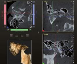 final quality, reduces artifacts and minimises reconstruction times. All with full control of the diagnostic image.
