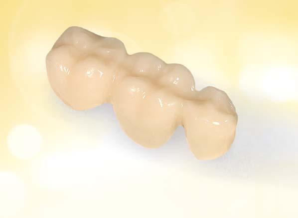 CEREC Blocs the original redefined The new Sirona CEREC Blocs are ideal for chairside applications.