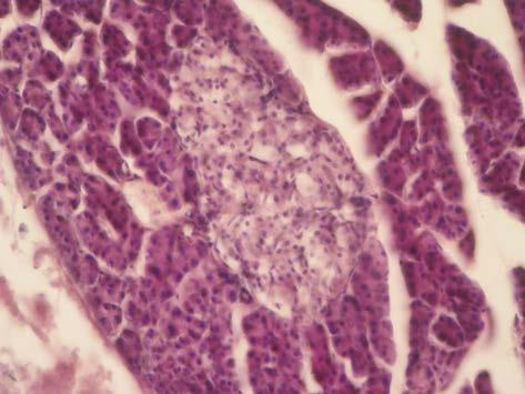 Pancreas section in treated rats, stained
