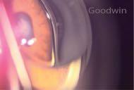 Common Errors While Performing Gonioscopy: It is common to get air bubbles between the gonioscopy lens and the cornea (See Figure 17).