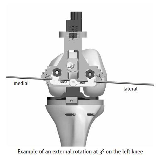 Rotation selection - Rotation may be selected according to the following anatomical and/or ligament reference: - The 3 anatomical references are: - Transepicondylar axis - Posterior condylar axis -