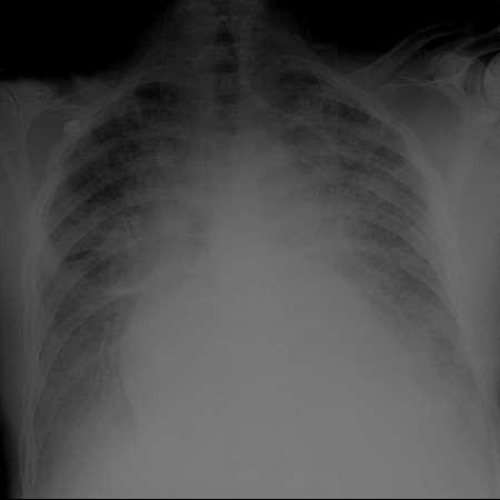 Case #4 A 65 year-old male with a history of
