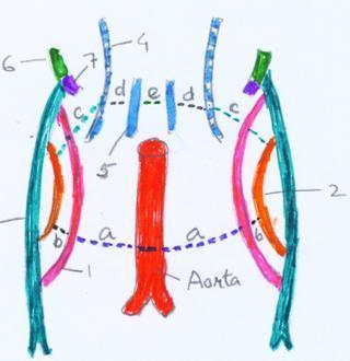 FIG 3: Anastomosis between venous channels 1- Subcardinal vein, 2- Supracardinal vein 3- Posterior cardinal vein 4- Azygos vein 5-