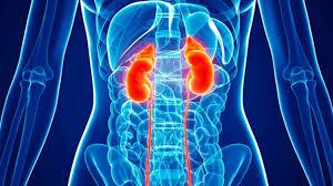 Kidney failure Kidney failure is life threatening and has a number of causes.
