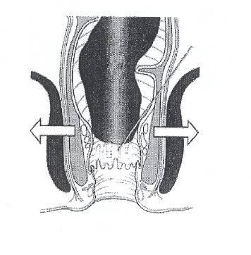 Both muscles wrap right around the anus. When stool moves into the rectum the internal sphincter relaxes and allows the stool to enter the top part of the anus.