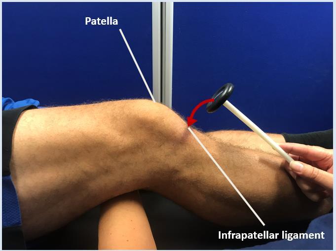 Reflex Testing of The Lower Limb Knee reflex (L3/4) Support one or both knees by placing your arm underneath the patients knee, so that they are slightly bent, strike the patellar tendon