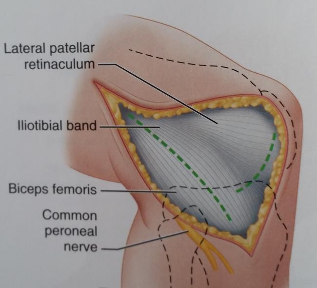LATERAL APPROACH TO THE KNEE To expose the lateral meniscus, make a separate lateral parapatellar incision through the fascia and joint capsule.