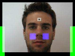 Facial grimacing Stationary Measure grimacing level: Segregate the face by two squares around the cheek Threshold the segregated area