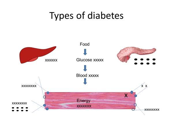 Diabetes medications: THEN Before 1993: 1ST Generation sulfonylureas beef/pork insulins, NPH, UL, Lente, and Reg (R) insulin.