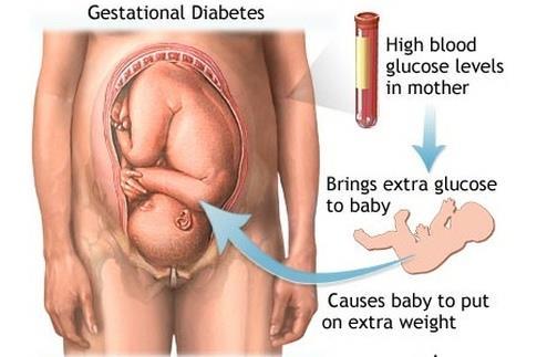 insulin receptors and GLUT4 activation Leads to rise in mother s blood glucose As baby grows, placenta makes more and more insulin blocking hormones.