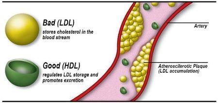 EVIDENCE-BASED RESEARCH: LIPID PROFILE In 2010, researchers at Emory University that took a sample of 6,000 adults.