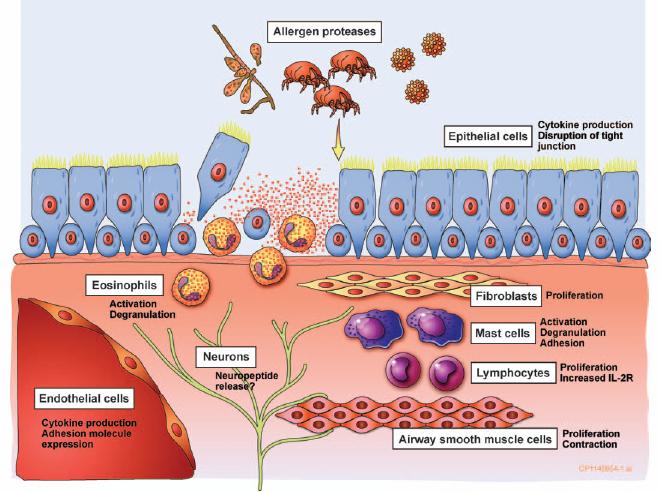 The role of protease activation of inflammation in