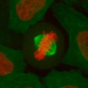 Spindle formation and positioning in DYNLL1-depleted cells.