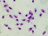 Amastigotes at edge of ulcer microscopy culture, c-