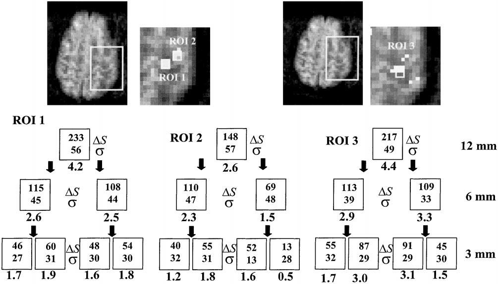 REAL-TIME ADAPTIVE FUNCTIONAL MRI 603 FIG. 5.
