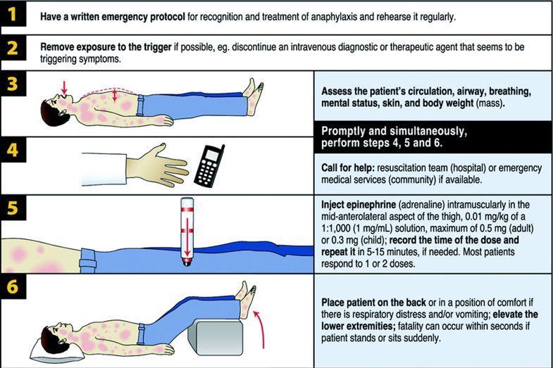 Anaphylaxis Management Remove trigger (Decontamination) BLS (Airway, Breathing,