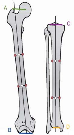 Quantify magnitude of Draw Either Mechanical or Anatomic Axes Mechanical axis of femur and tibia Anatomic axis of the femur and tibia Joint Orientation Lines (JOL) Steps to Identify & characterize 1.