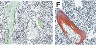 FGF23 induced hypophosphatemia impairs mineralization
