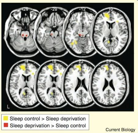 Sleep and Emotional Regulation Sleep impacts response to positive