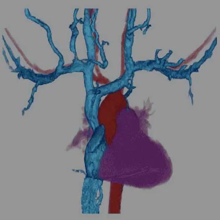 Relationship to Arteries Arteries BEHIND veins Veins